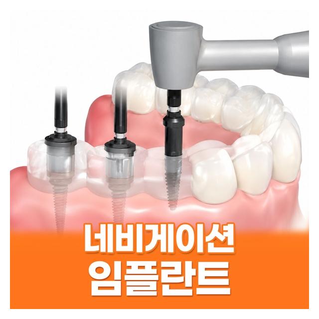 네비게이션 임플란트 컴퓨터 모의수술 최적의 수술결과